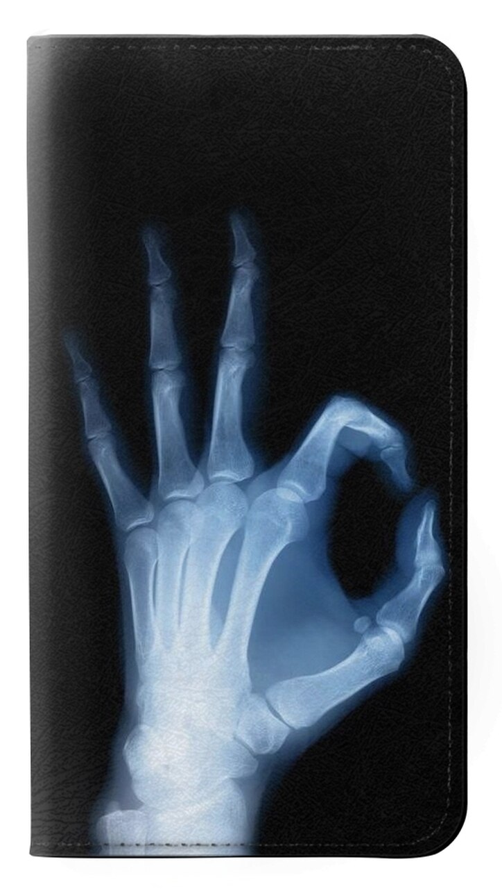 Mejores Fundas LG X Ray